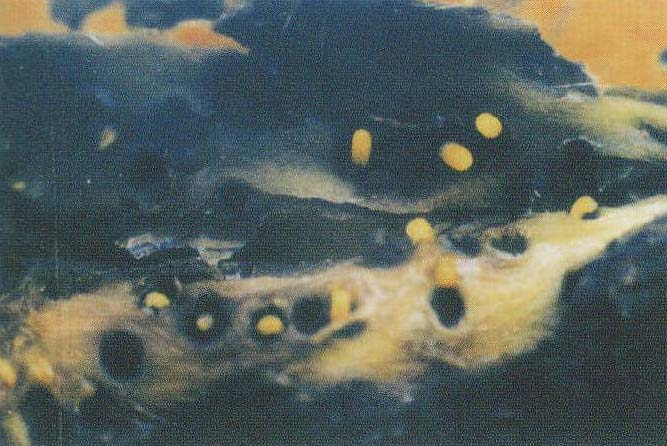 图309 枸杞枝瘿蚊幼虫在瘿瘤内危害状